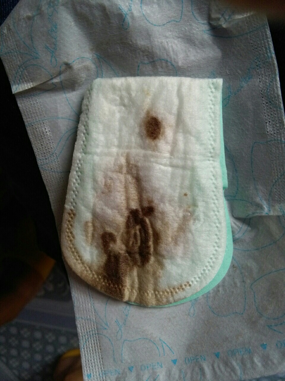 非月经期有流褐色的血