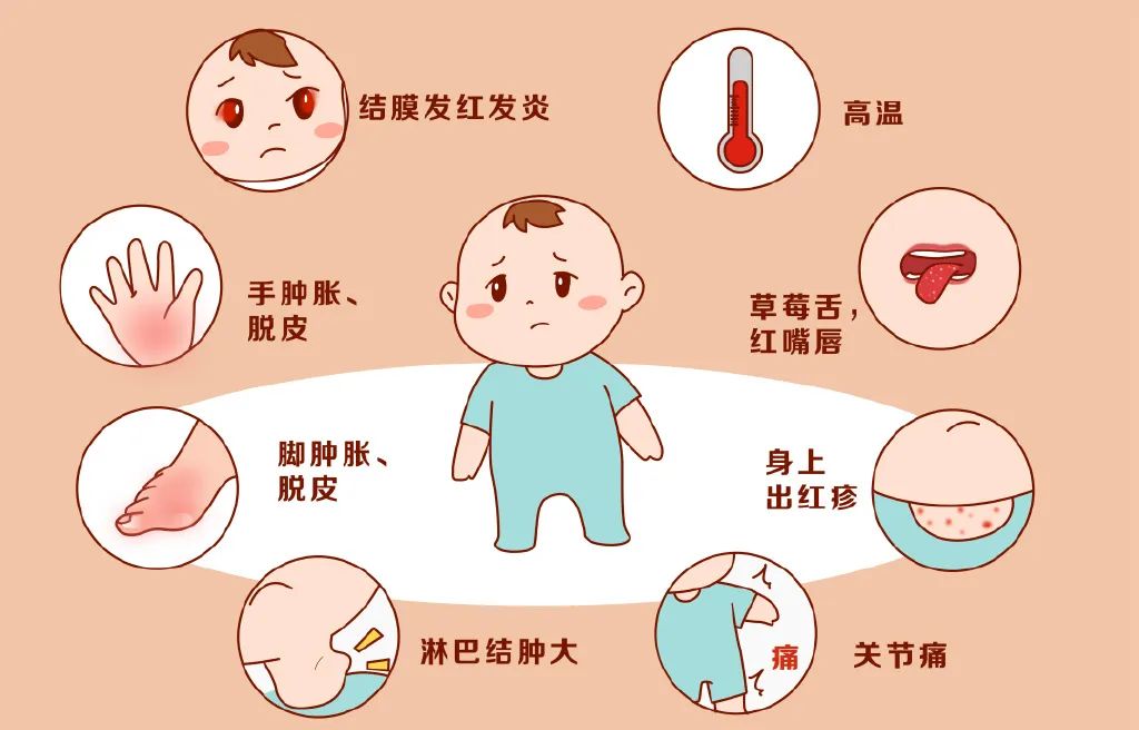 什么是川崎病?