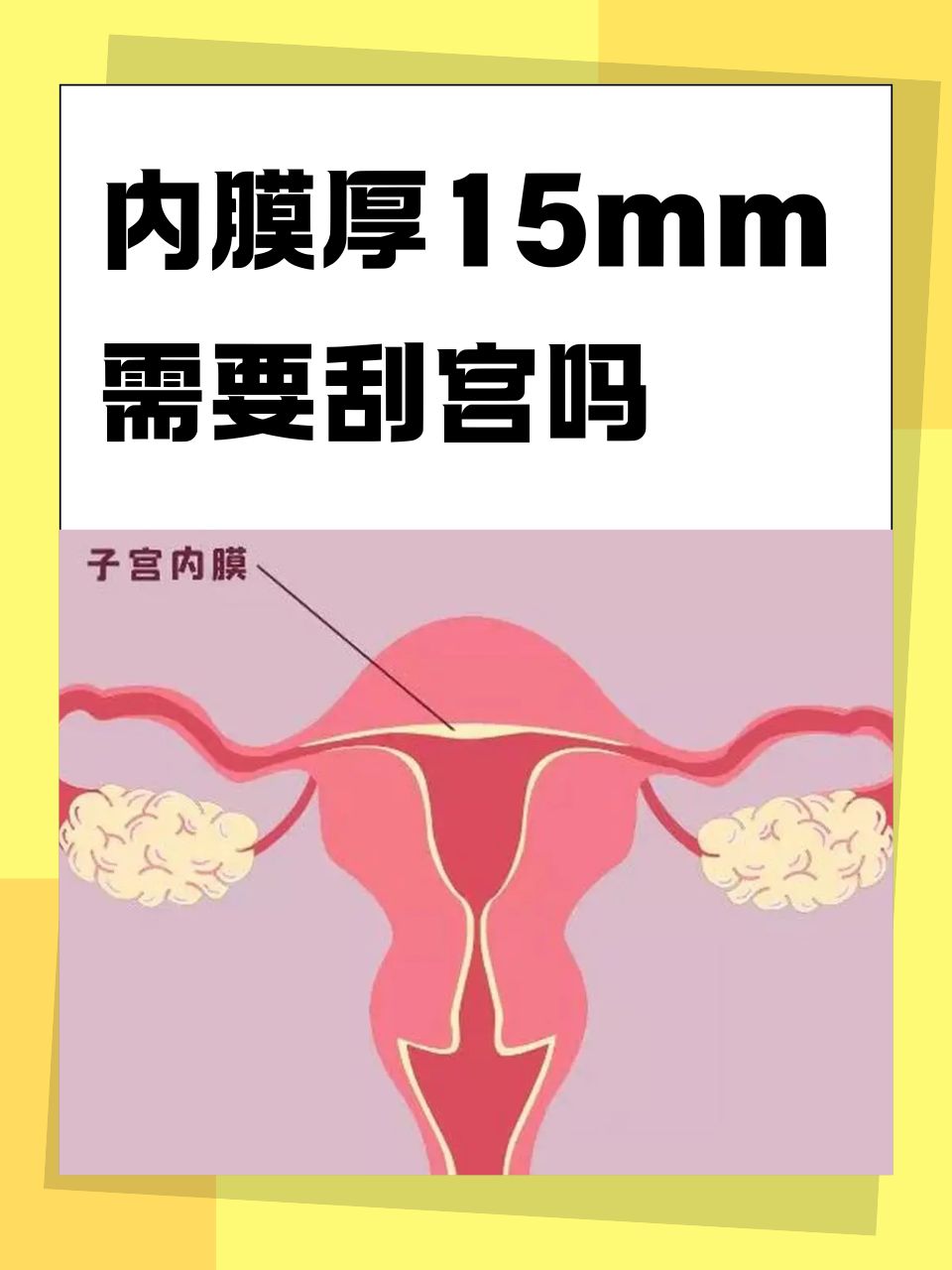 子宫内膜厚度标准是什么