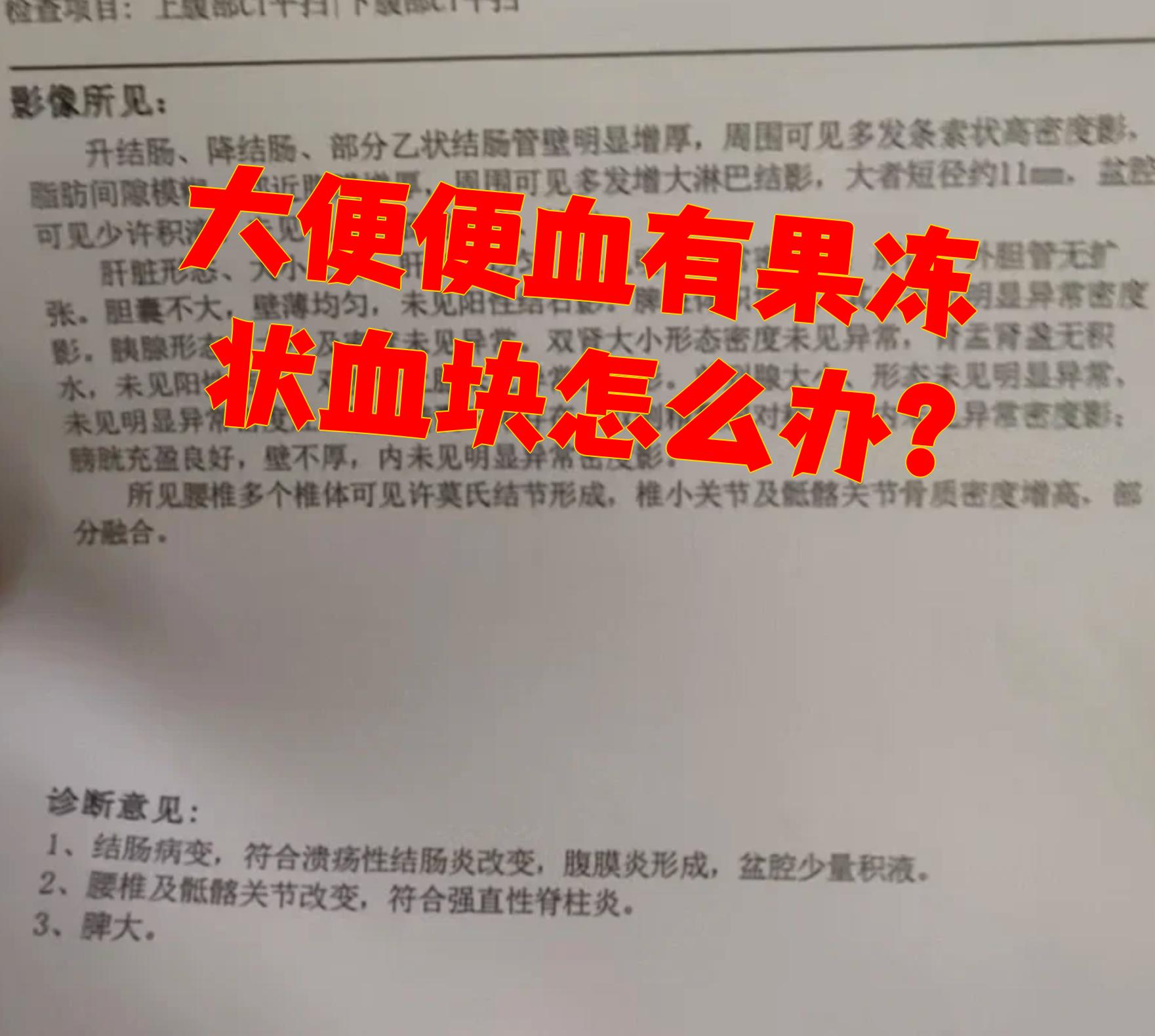 大便带血是不是癌症
