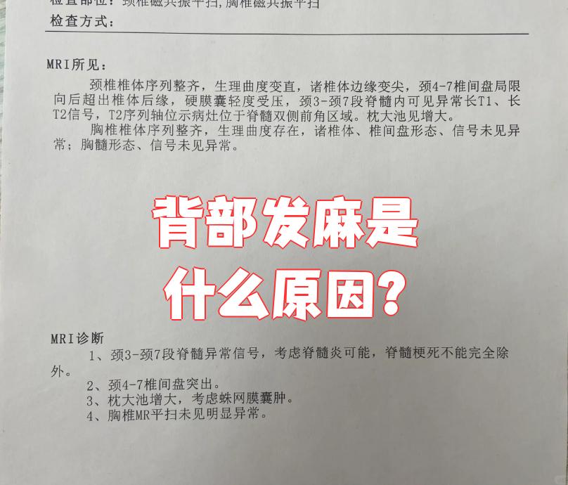 什么是脊髓空洞症