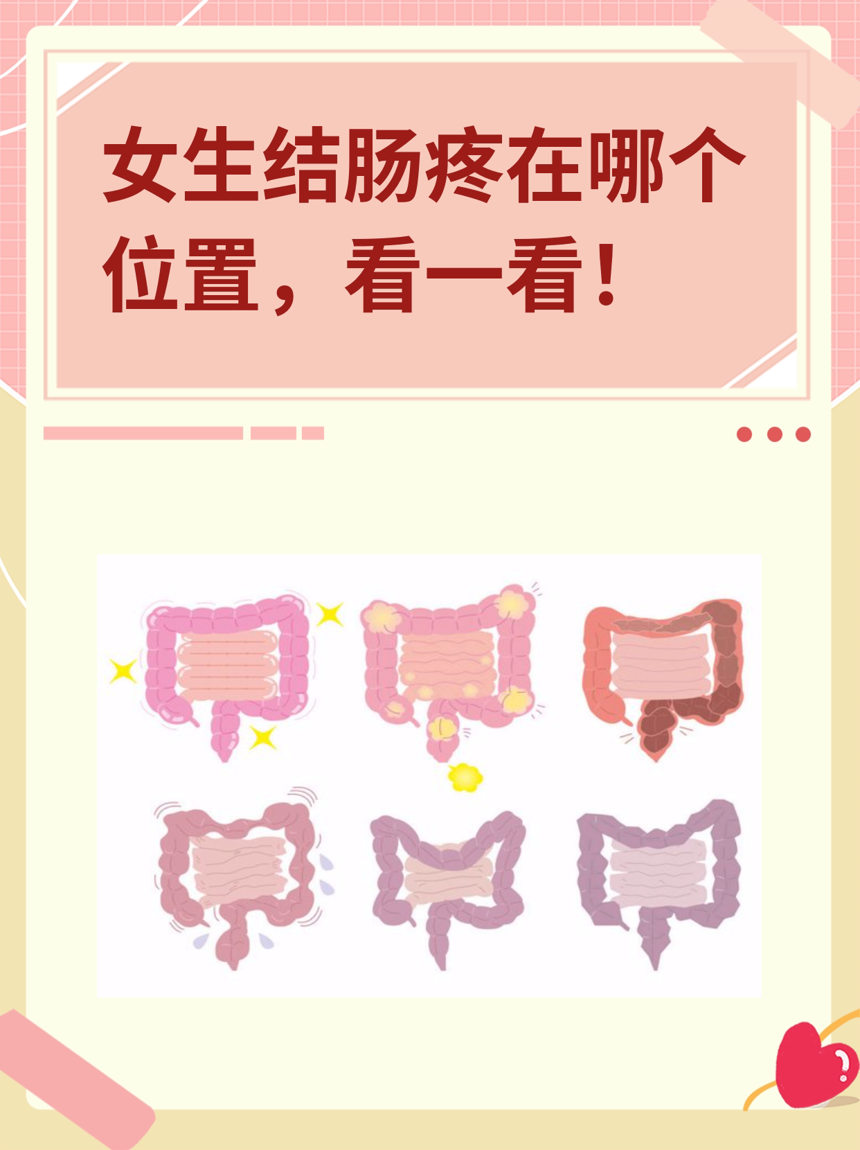 结肠炎的症状有哪些
