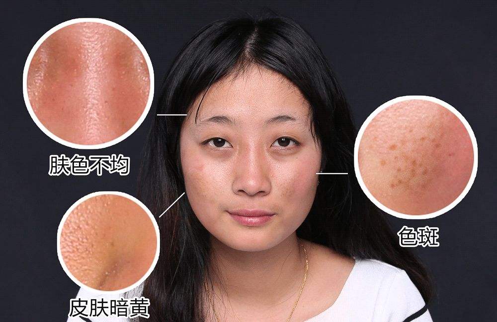 男生内分泌失调的症状
