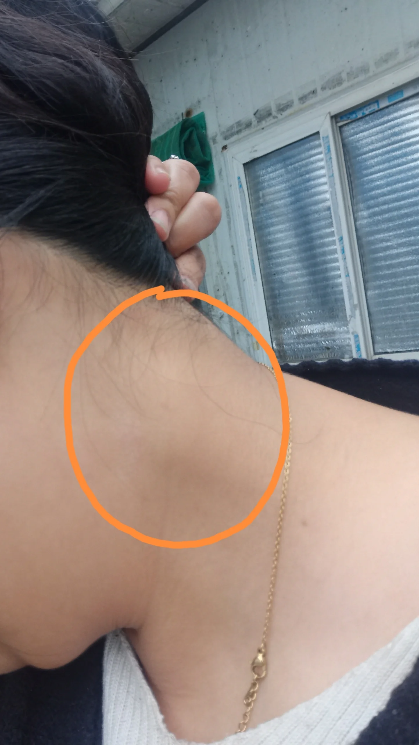 脖子里面有个疙瘩,什么导致的