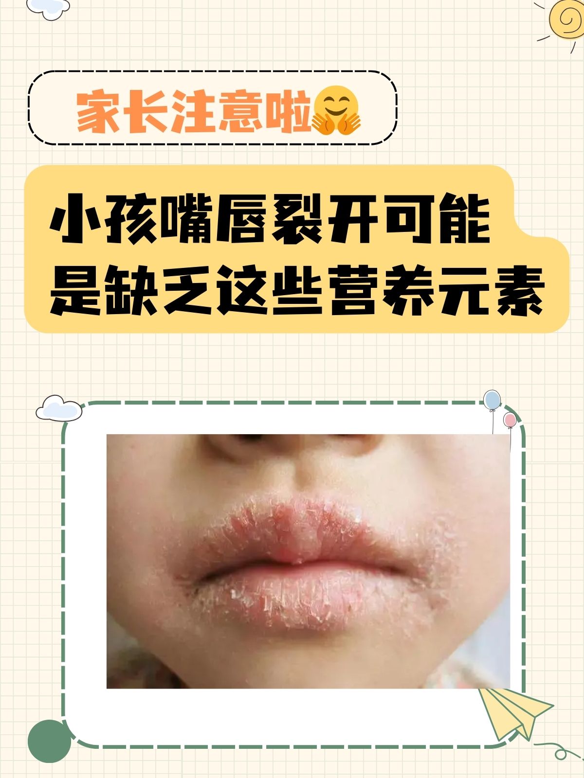 引起唇裂是什么原因造成的
