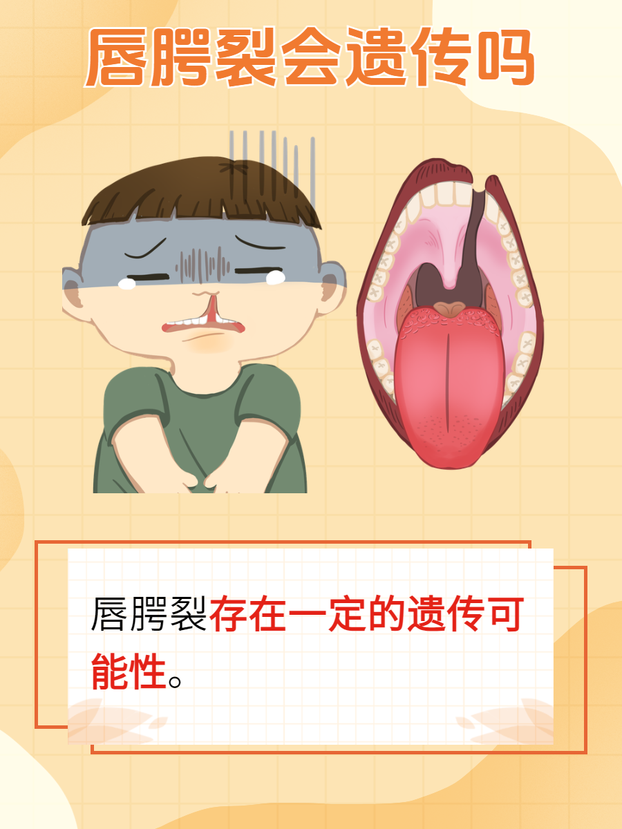 引起唇裂是什么原因造成的