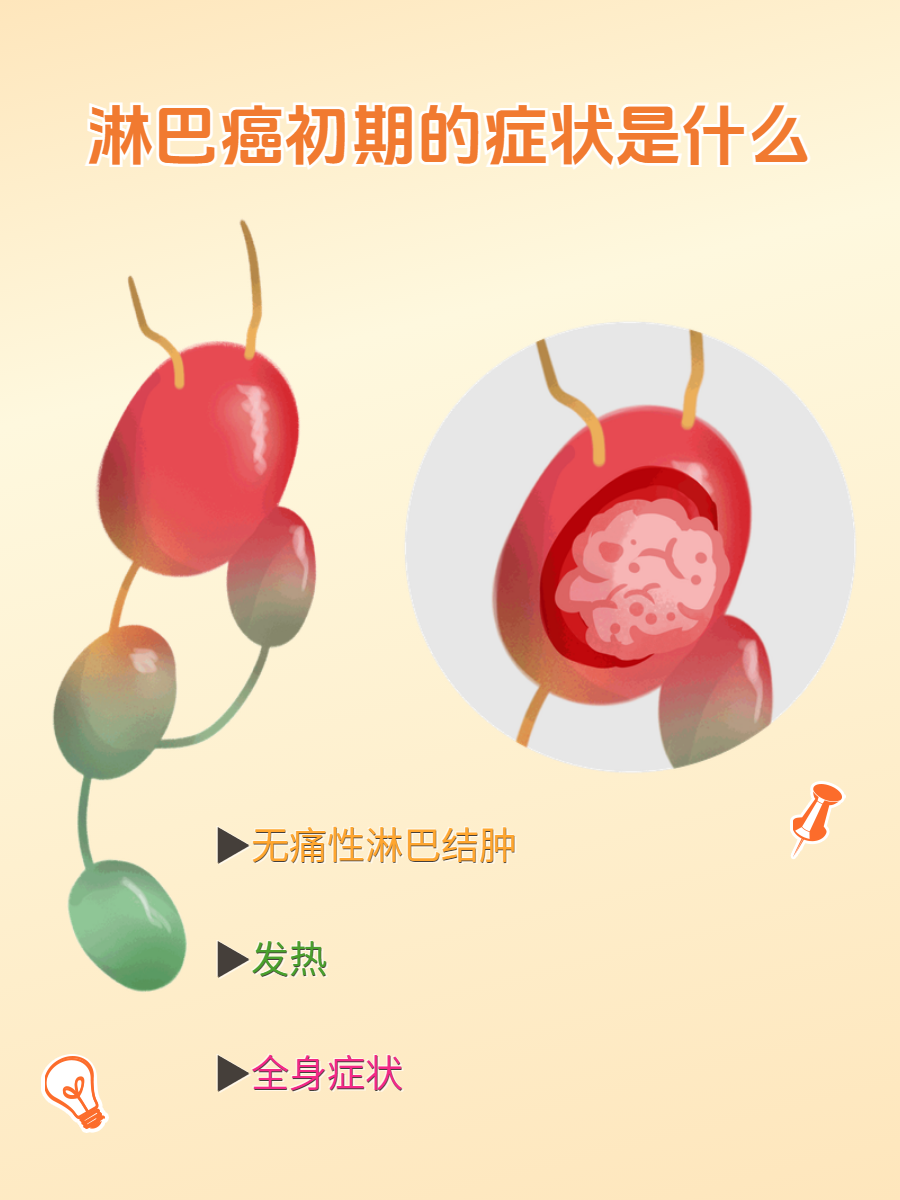 恶性淋巴瘤临床表现