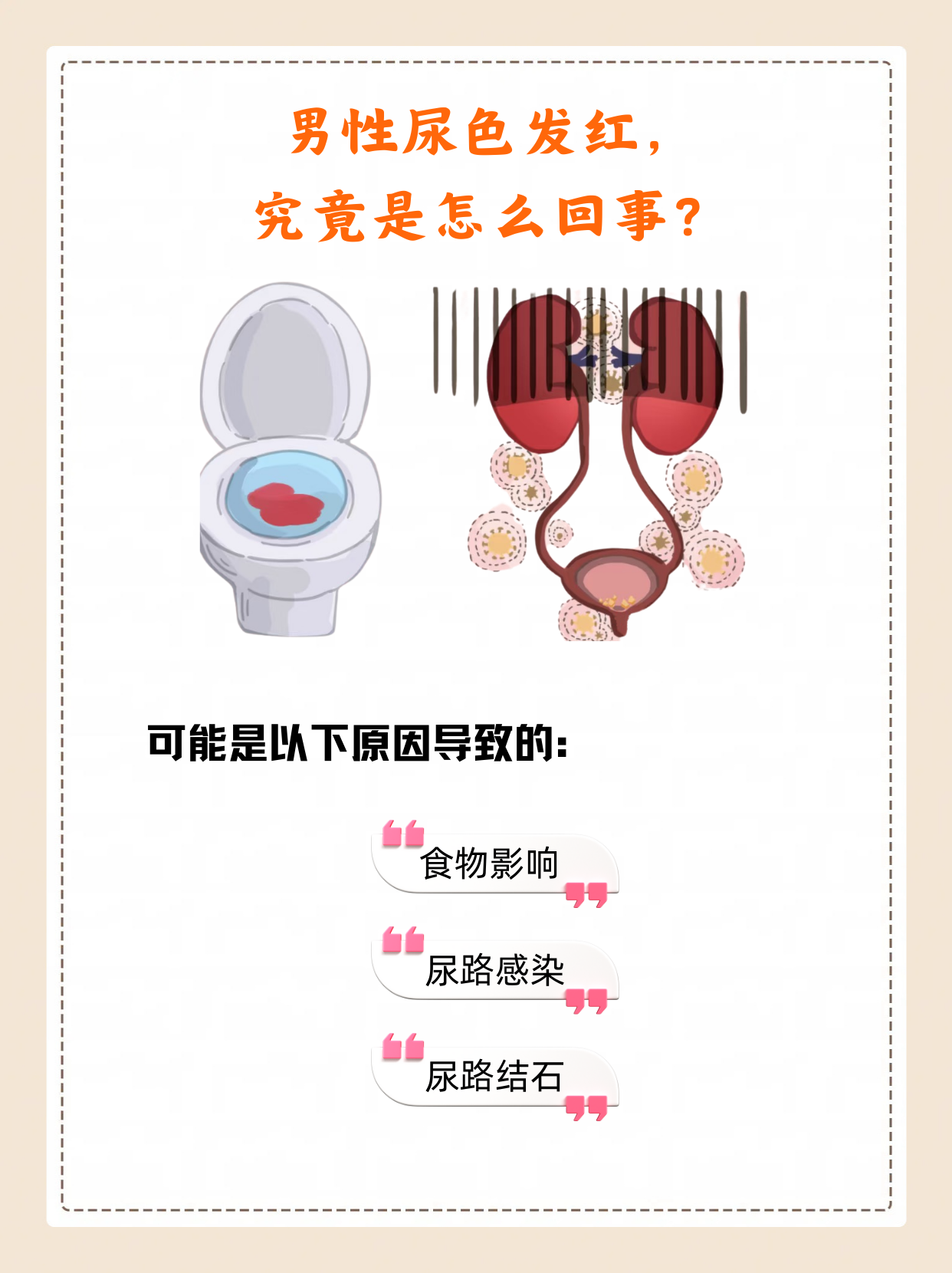 小便频繁是什么原因