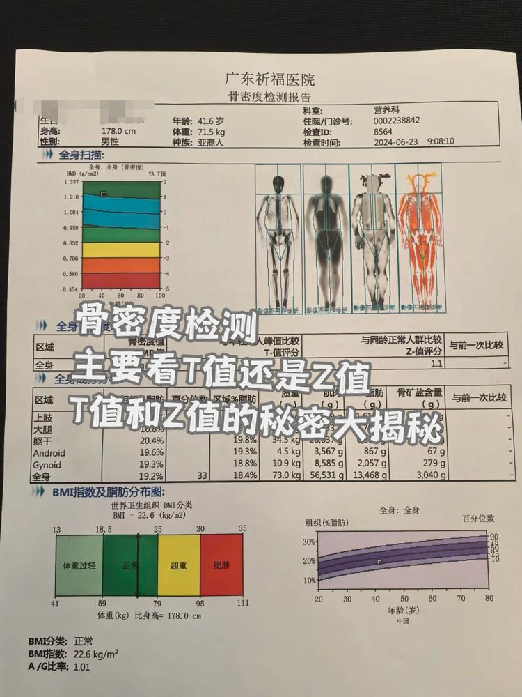 正常孩子的骨密度是多少?