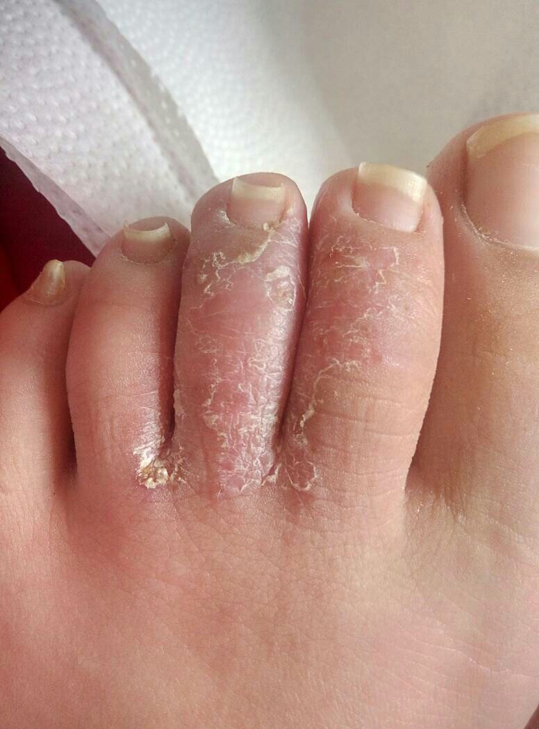 请问是怎么引起的?