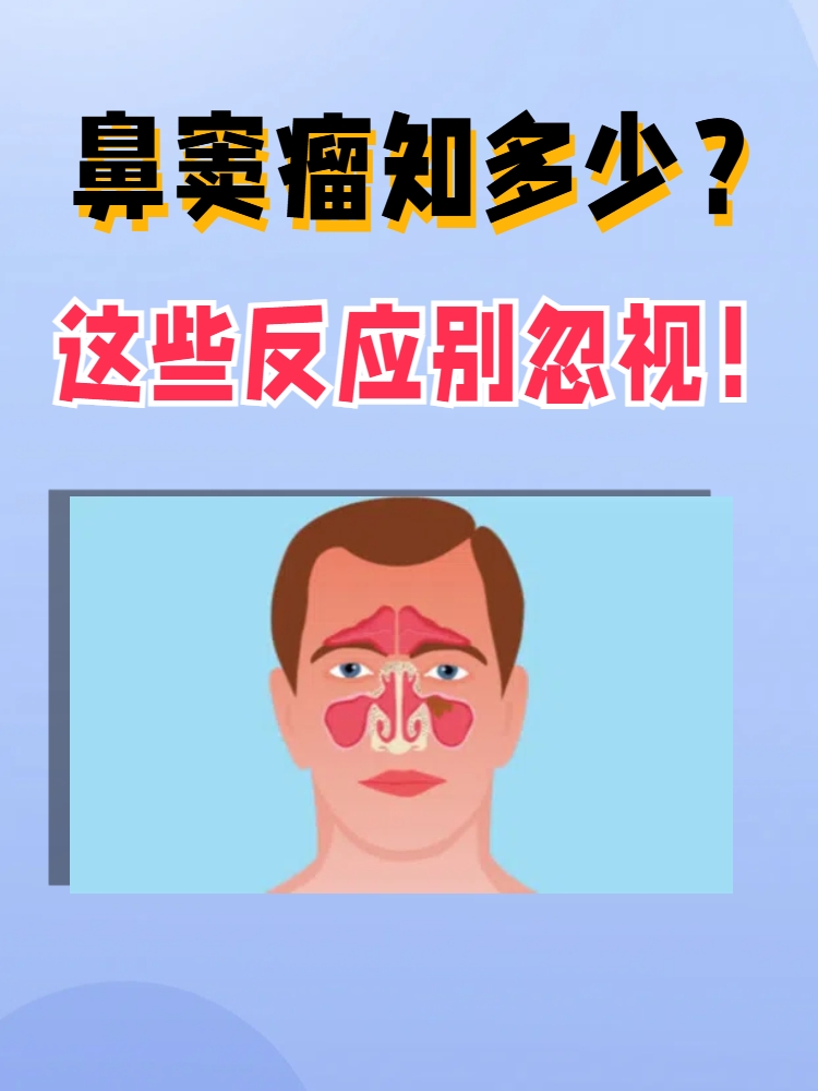 什么是鼻窦癌哪些人易得鼻窦癌