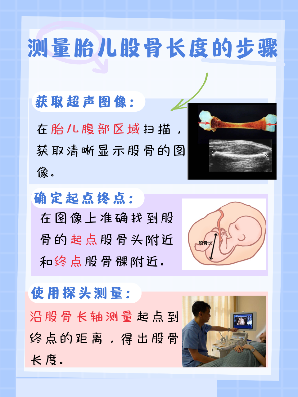 胎儿股骨偏短怎么办?