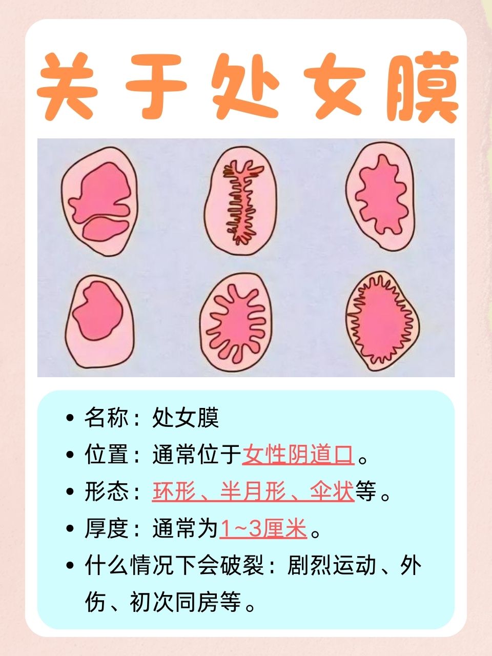 处女膜可自动修复吗?