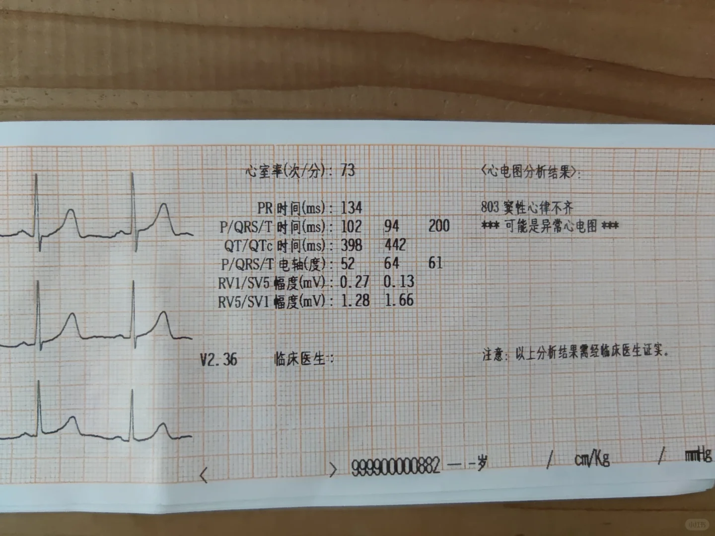窦性心律不齐能跑步吗