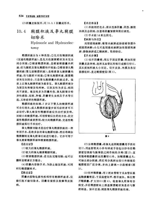 精索鞘膜积液手术