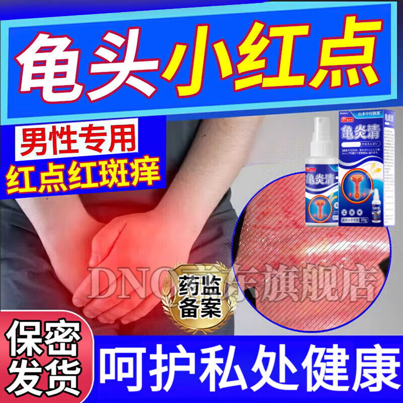 龟头上有红点,不疼不痒