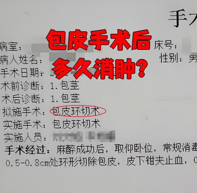 包皮手术几天消肿