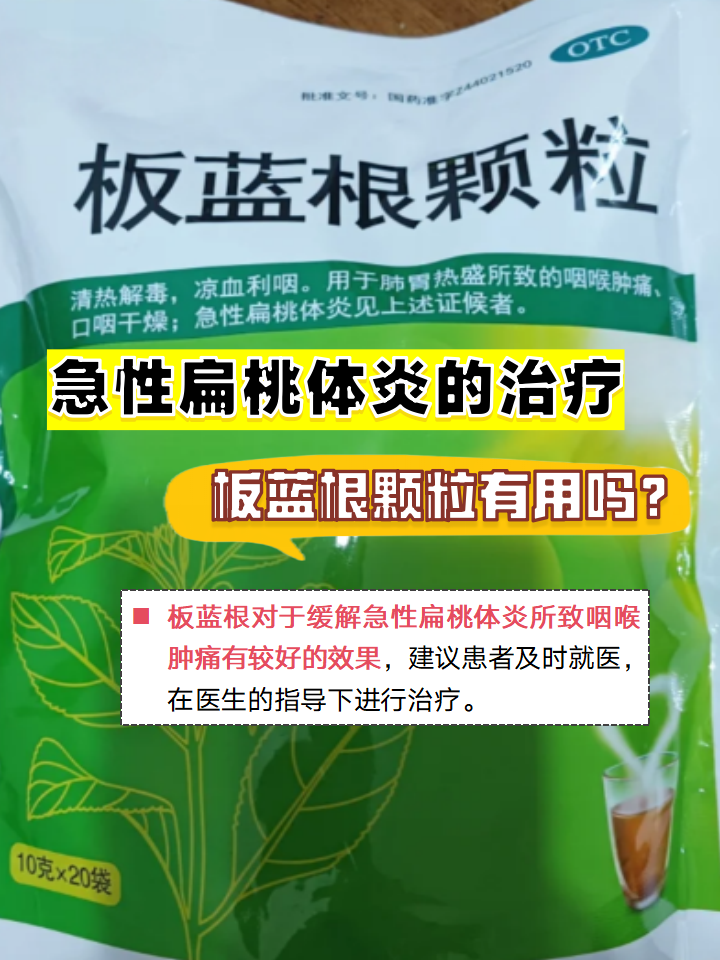 扁桃体发炎吃什么药好