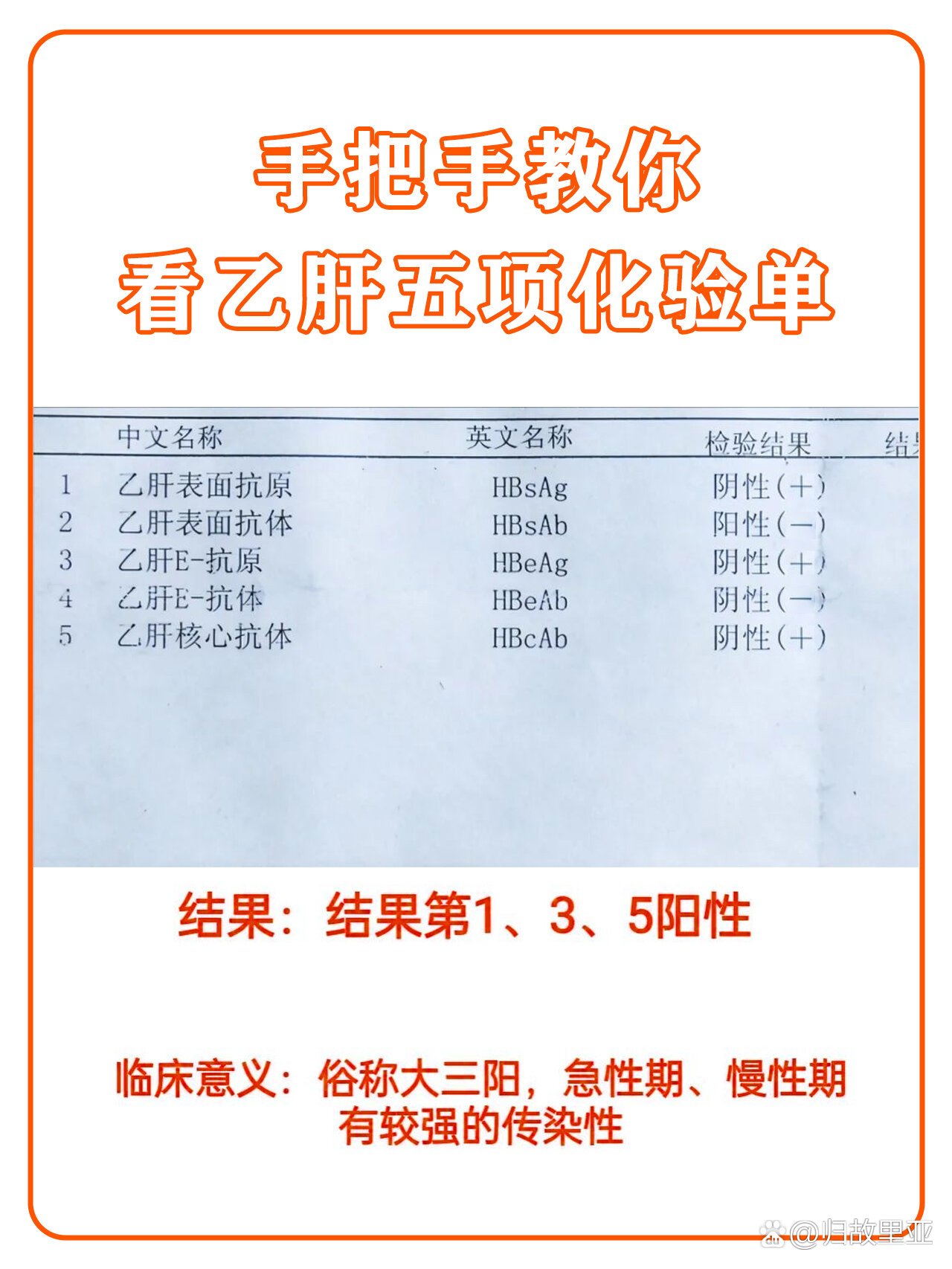 乙肝检查要多少钱?