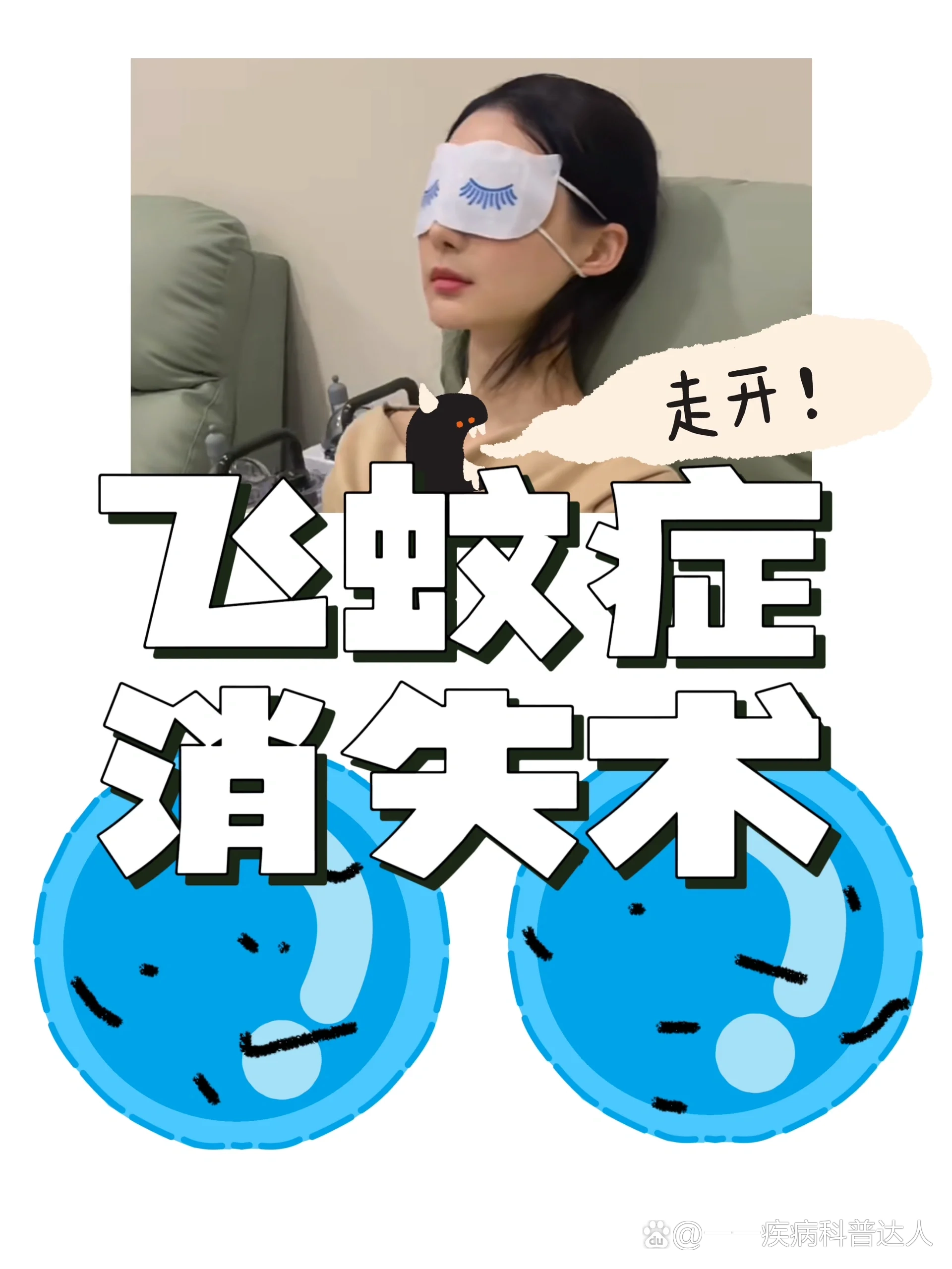 得了飞蚊症怎么治