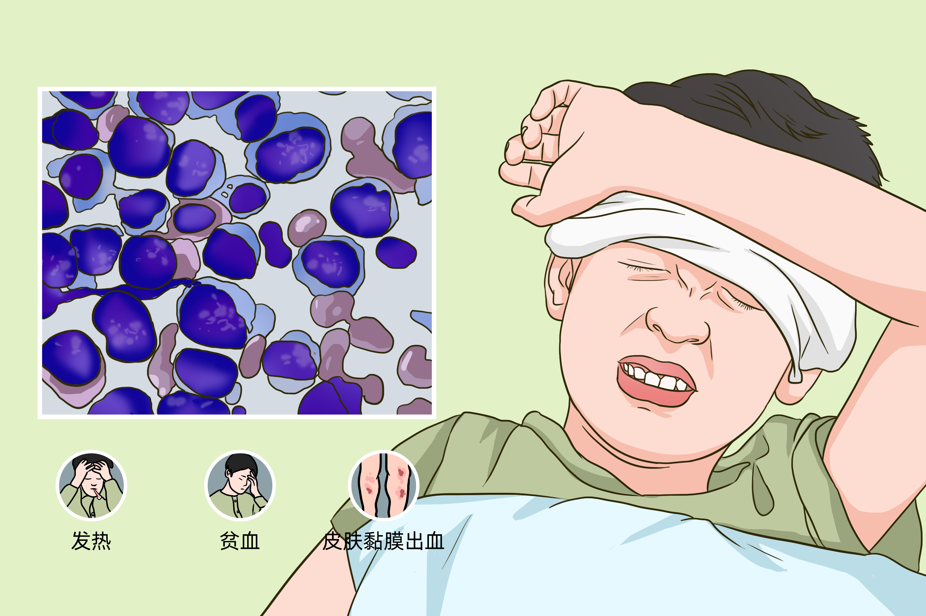 儿童为什么会患上白血病