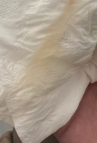 白带黄有点像鼻涕但不多不痛不痒