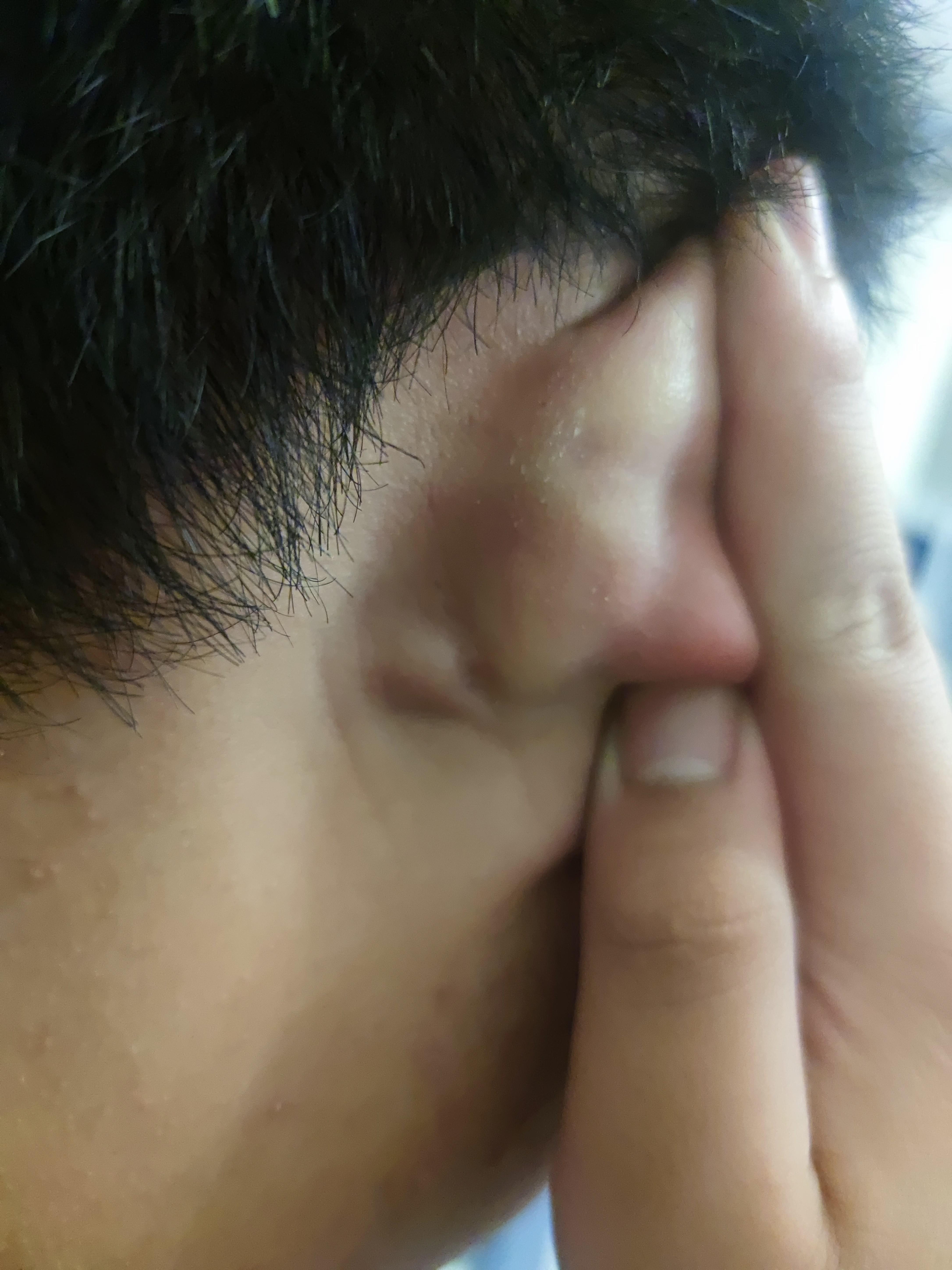 耳朵后面一跳一跳的疼