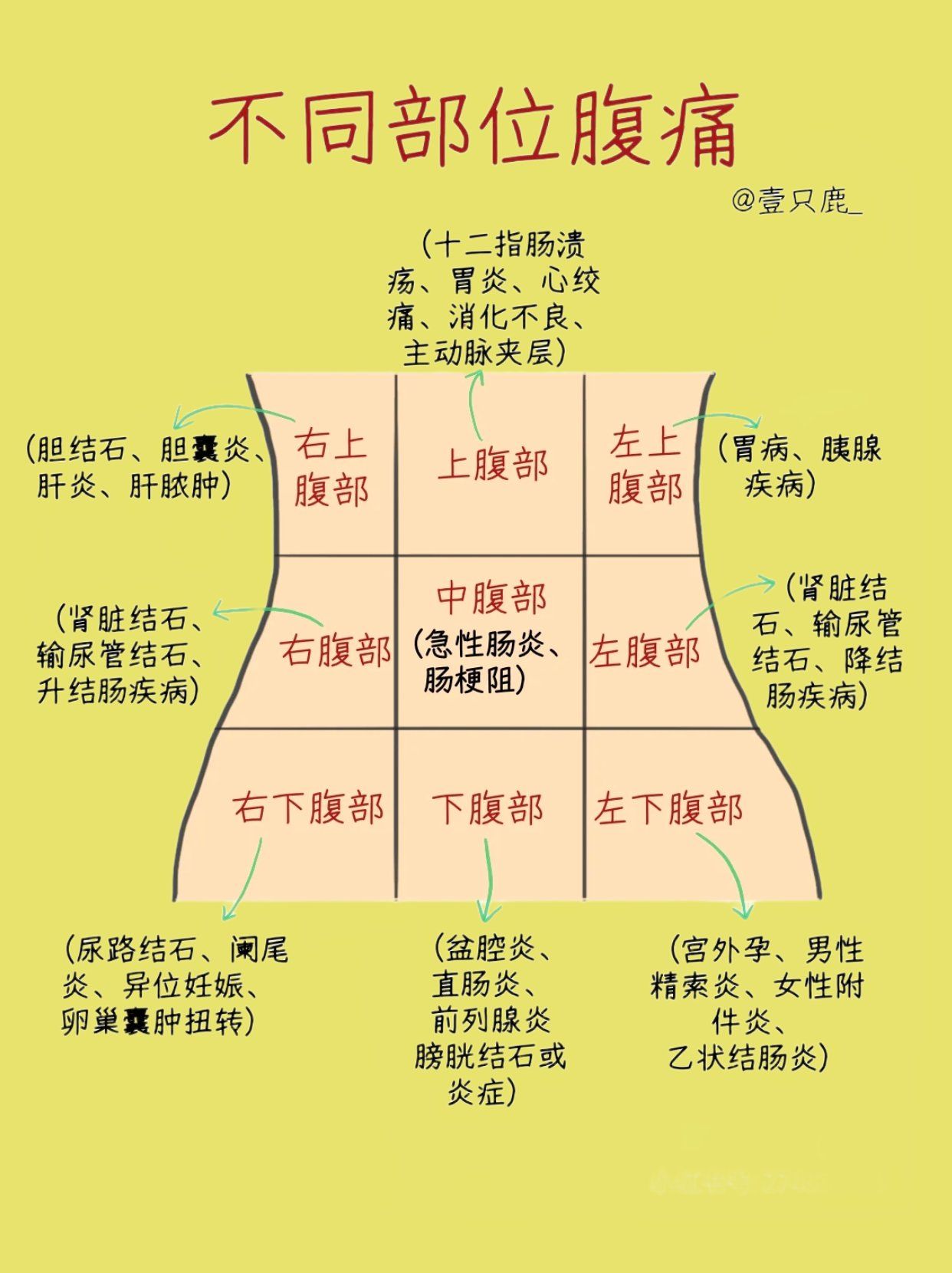急性腹膜炎的体征?