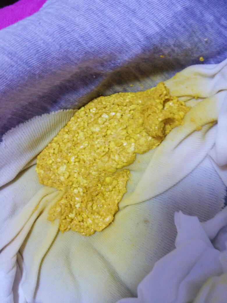 宝宝大便干燥拉不出来