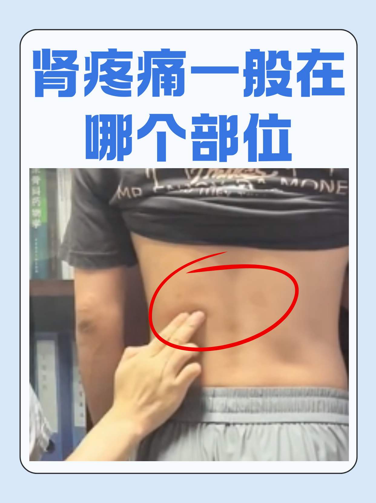 肾脏有问题腰会疼吗?