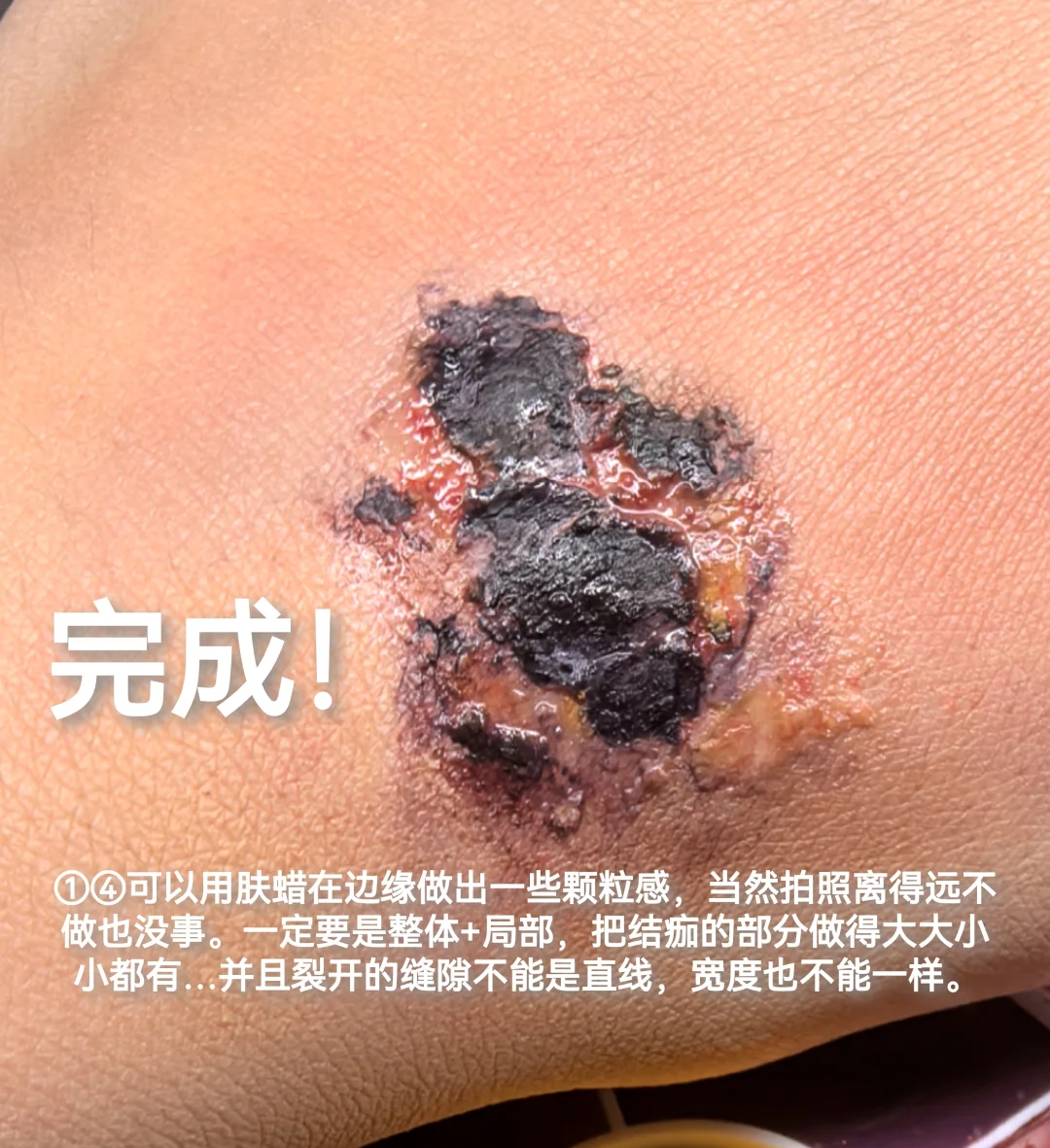 伤口结痂多长时间脱落?
