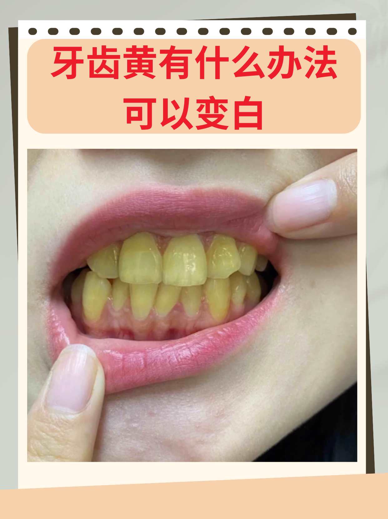 牙齿为什么会变黄