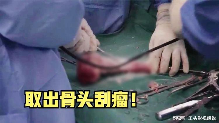 骨肿瘤能不能治好