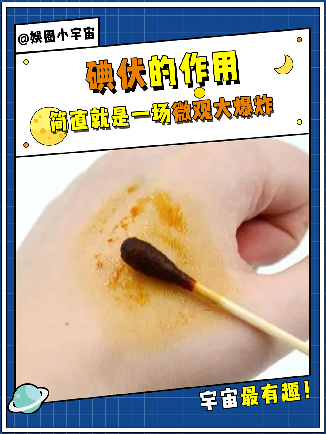 碘伏能直接涂伤口上吗
