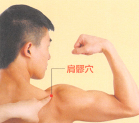 肩周炎针灸哪个穴位