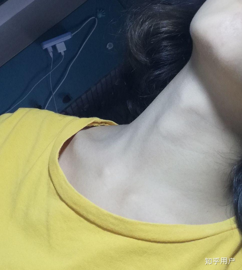 女生喉结突出