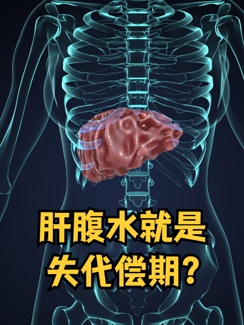 肝腹水的早期症状有哪些?