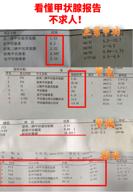 甲状腺素偏高