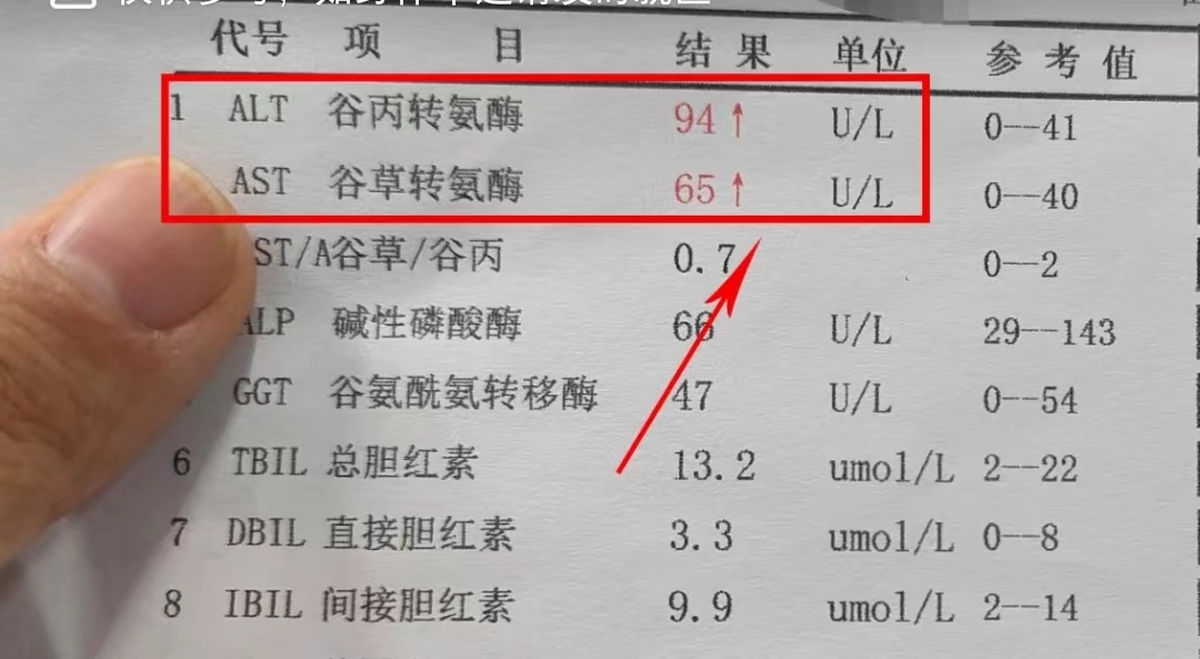 谷草转氨酶和谷丙转氨酶偏高的原因