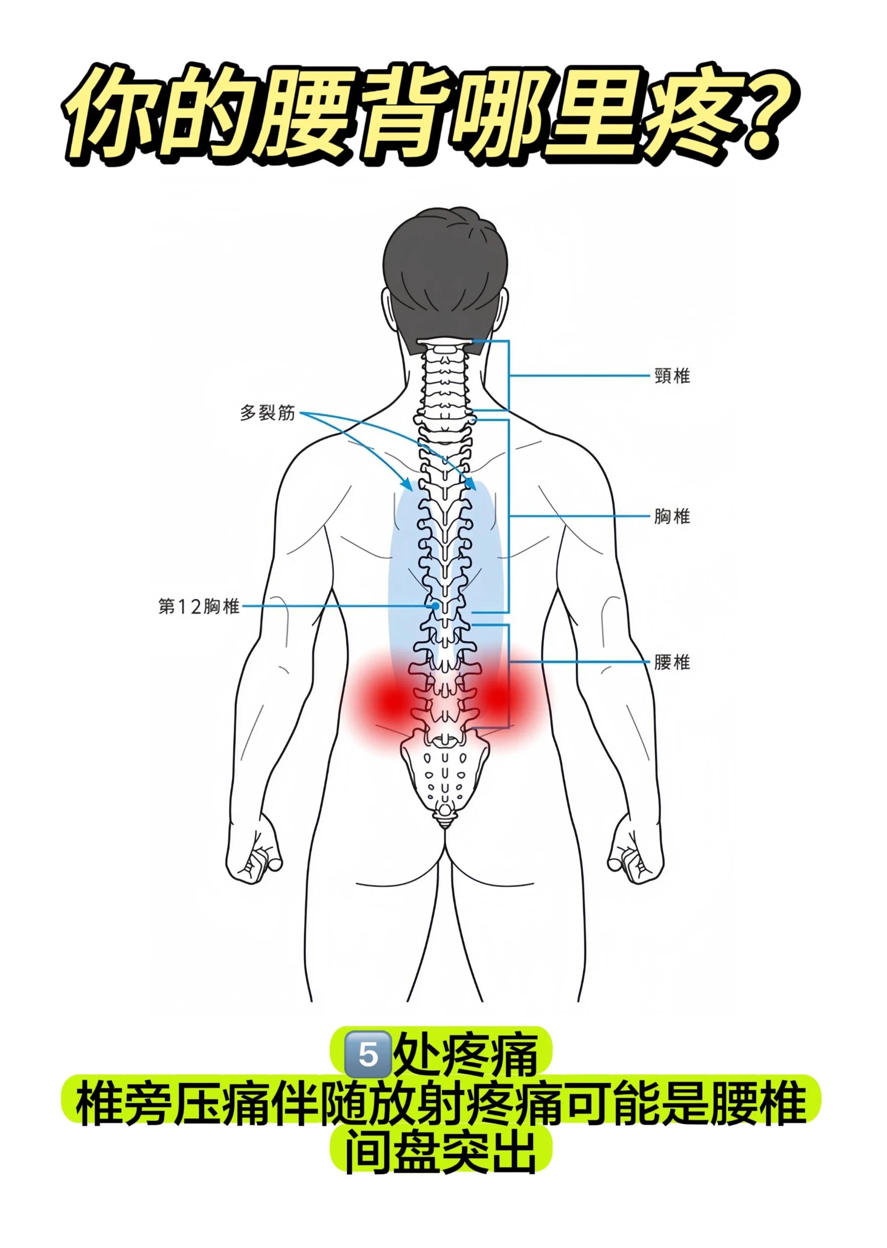晚上睡觉腰疼是怎么回事?