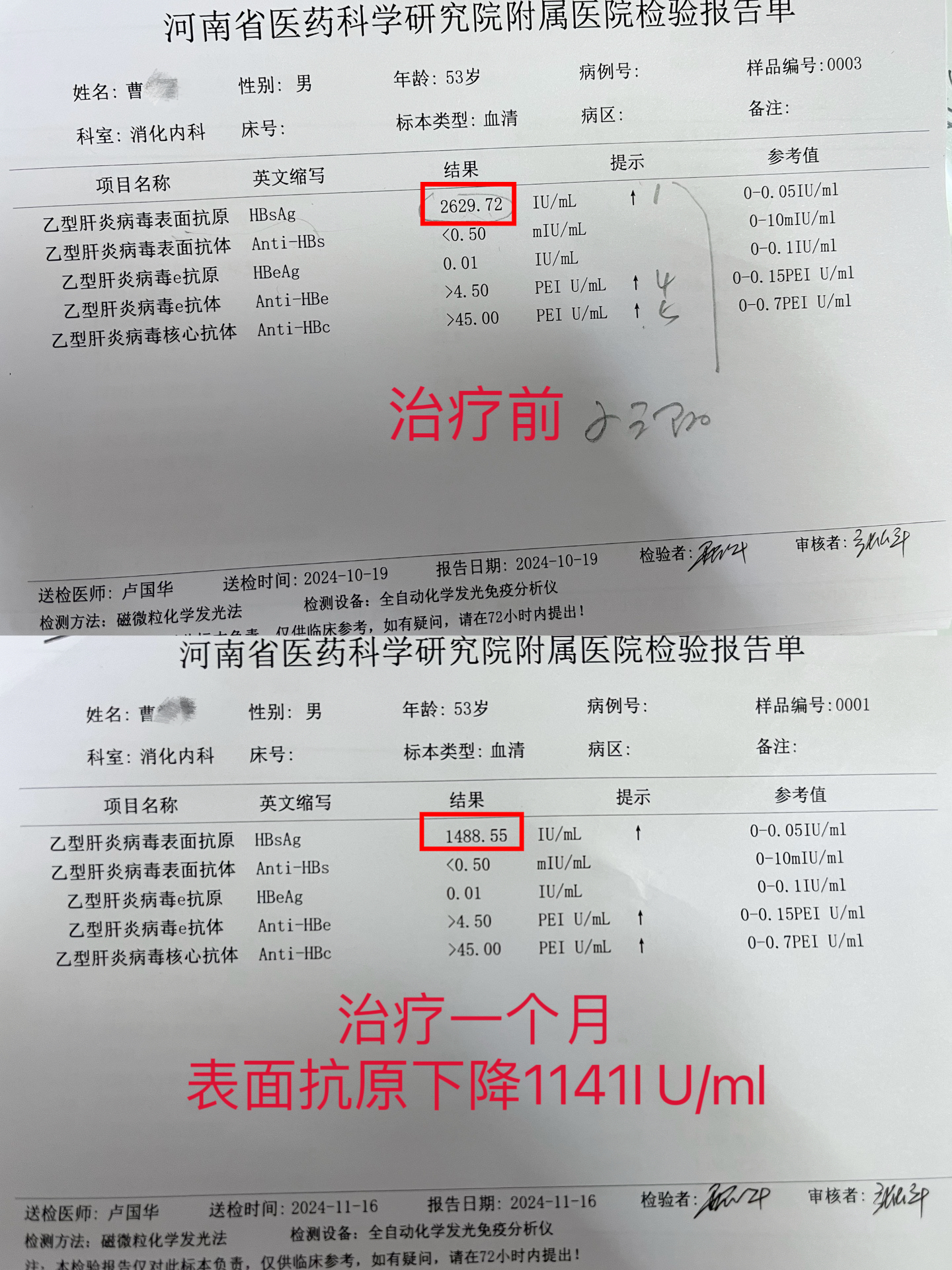 乙肝要怎么治呢