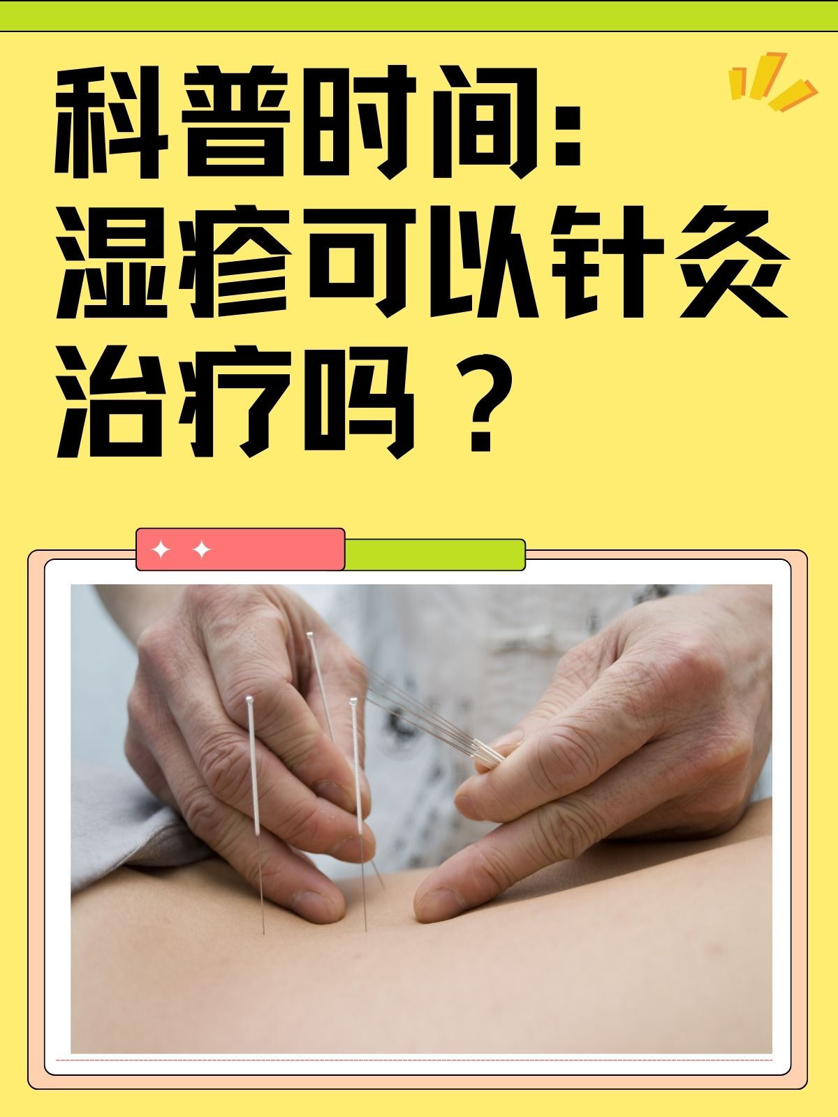 皮肤瘙痒症怎么治疗.