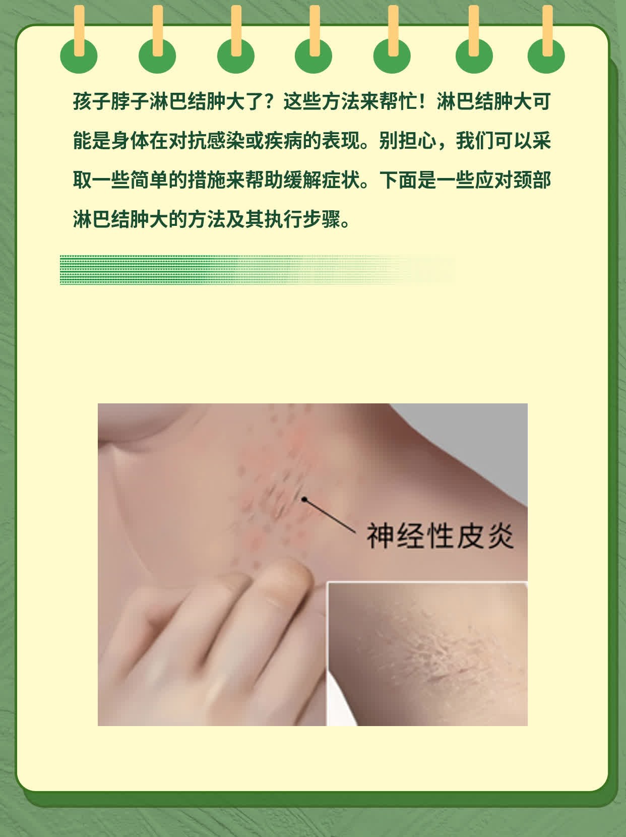 淋巴发炎怎么治疗