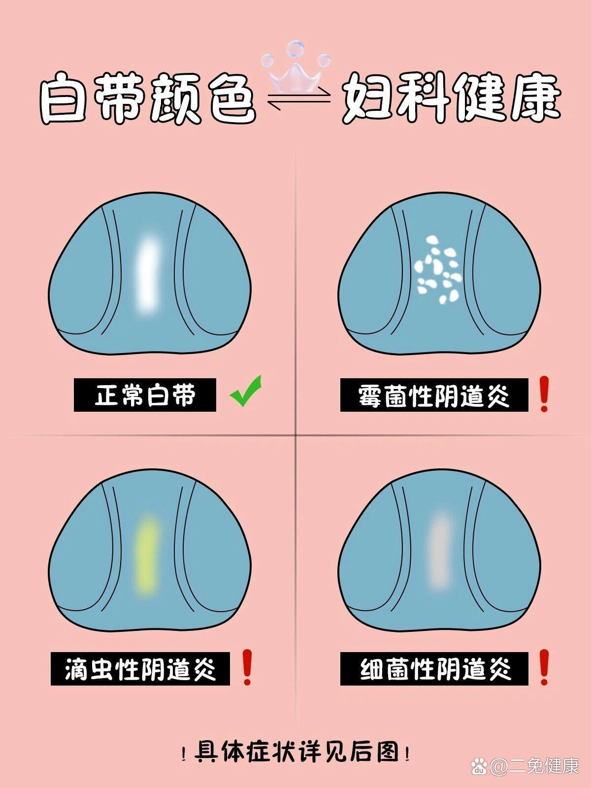 怀孕了白带会增多吗