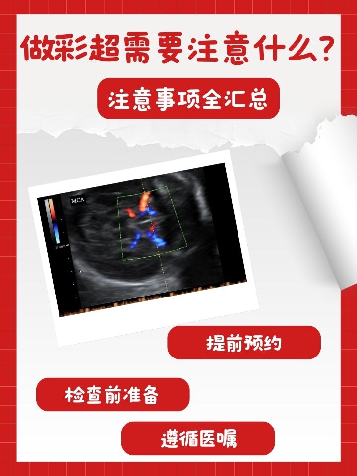 彩色多普勒超声检查是什么