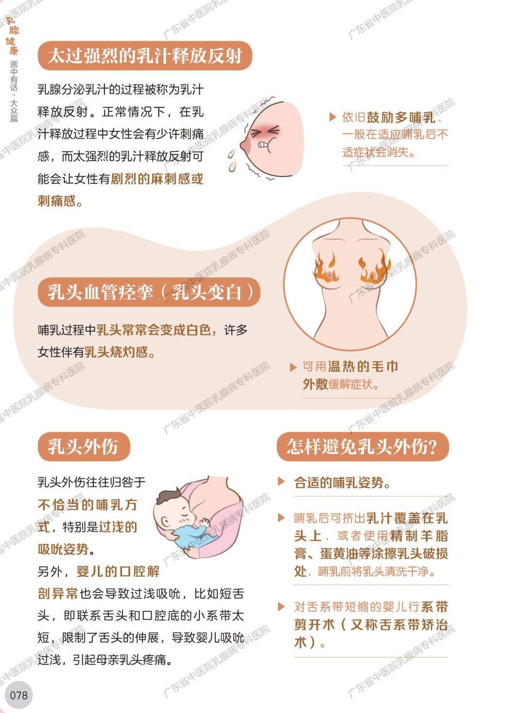 女性乳头疼痛是什么原因?