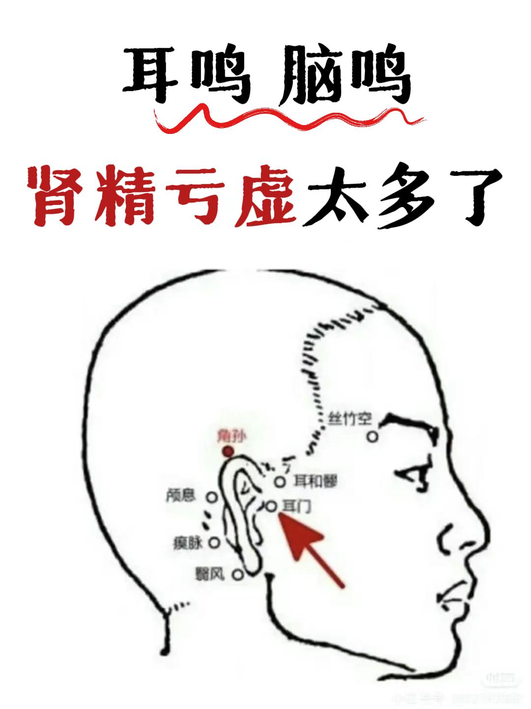 耳朵一直耳鸣怎么办