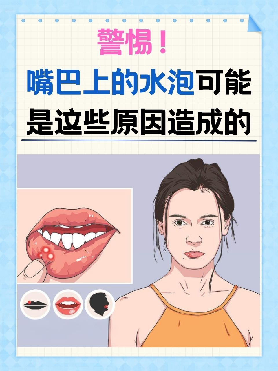 嘴上起水泡怎么快速好