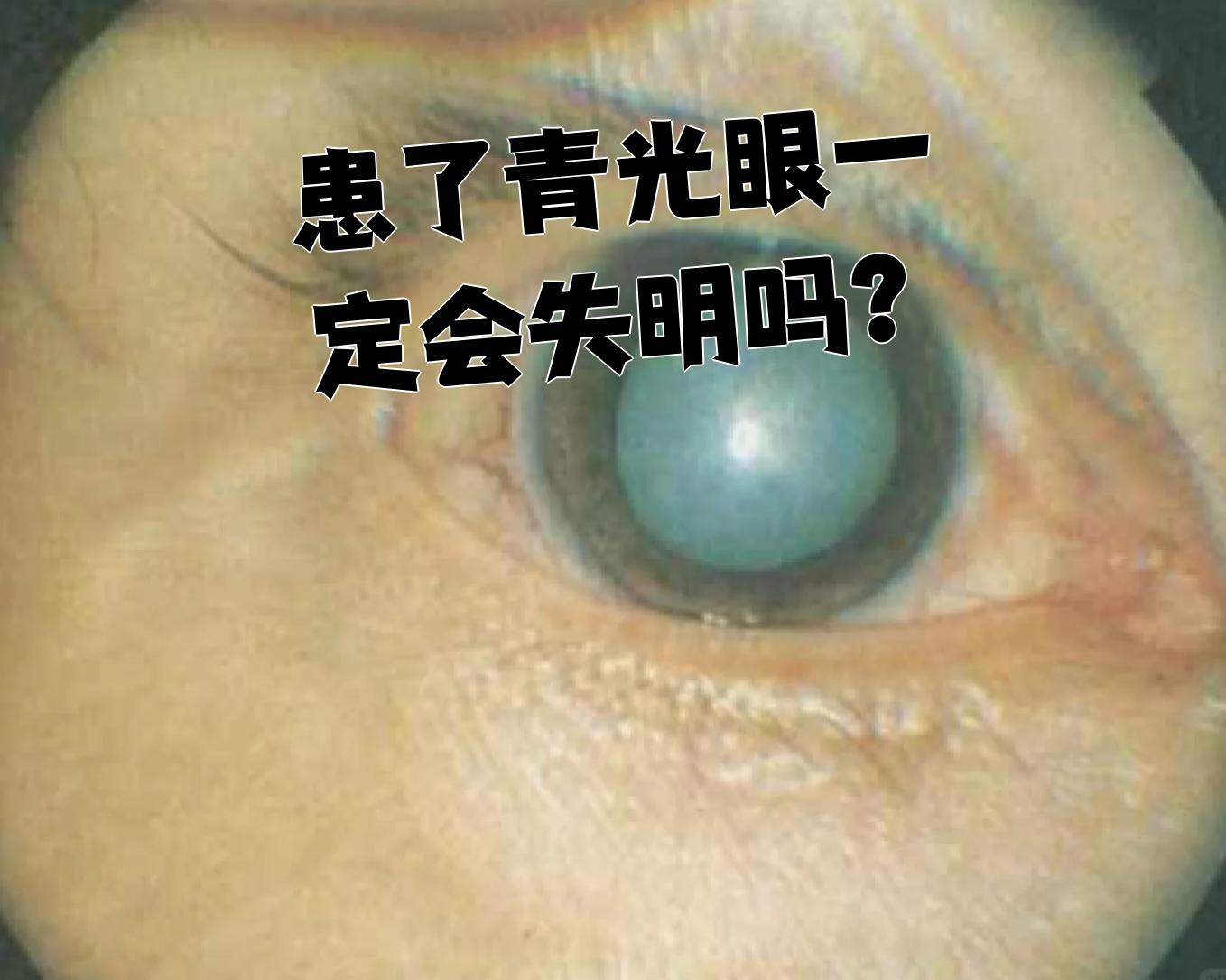 眼睛怕光是怎么回事