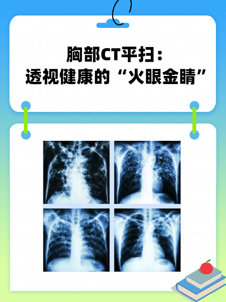 X线和CT的区别